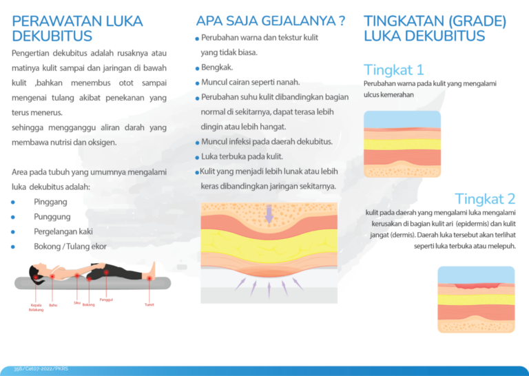 Leaflet Dekubitus Rumah Sakit St Carolus